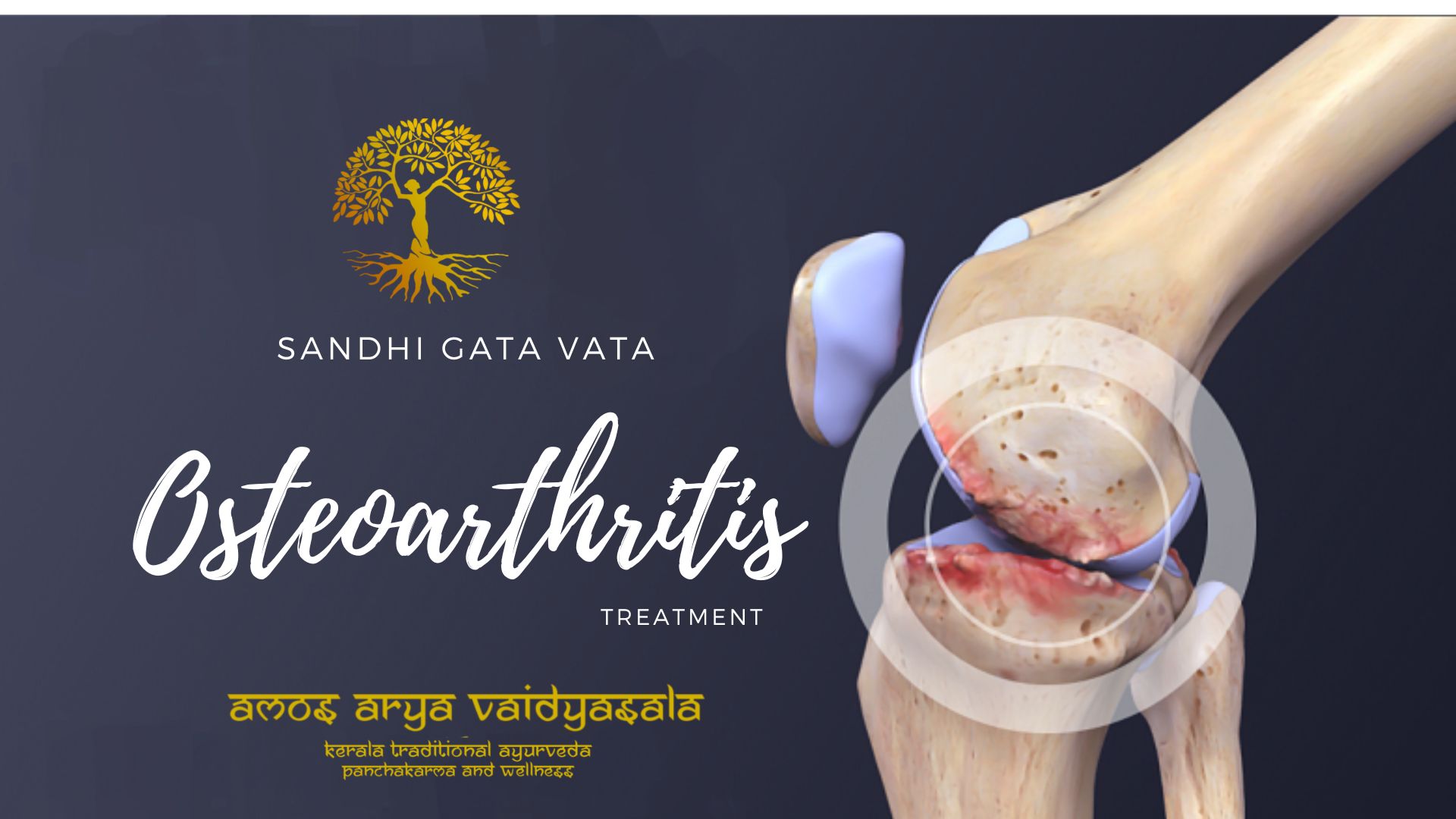 Osteoarthritis Ayurvedic treatment 